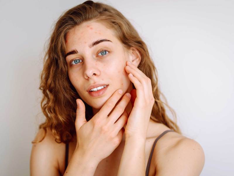 Close-up-Porträt einer schönen Frau ohne Make-up mit unvollkommener Haut.