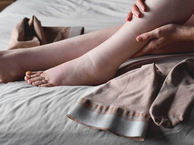 Frau beim Anziehen von Kompressionsstrümpfen für geschwollene Füße, die von einem Lymphödem betroffen sind