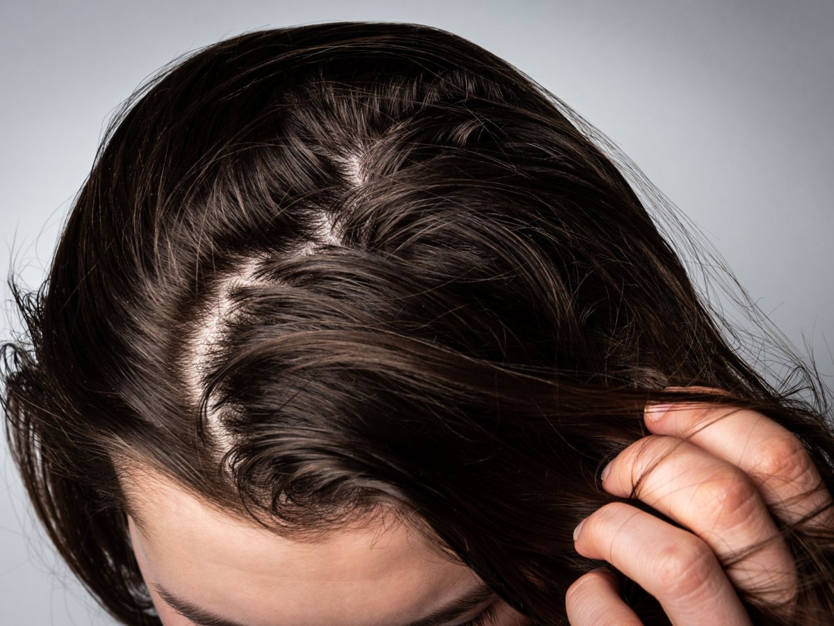 Frau, deren Ansätze an den Haaren leicht fettig sind.