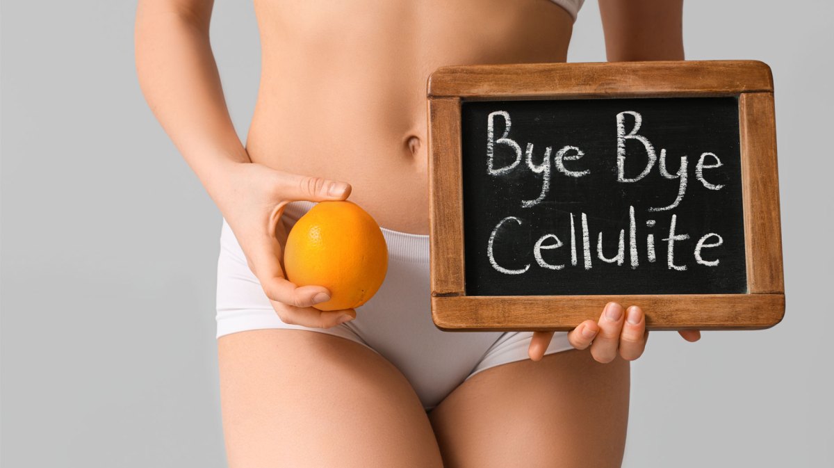 Frau, die ein Schild mit "Bye, bye Cellulite" in der Hand hält